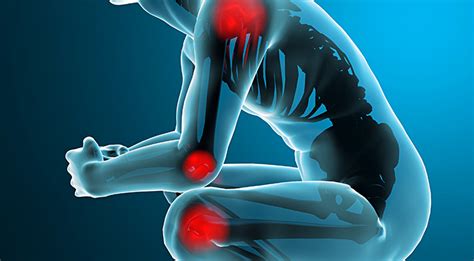 Причины и лечение боли в крупных суставах и мышцах